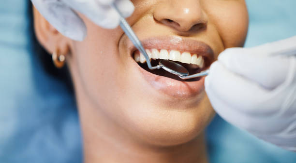 Best Emergency Dentist for Knocked-Out Tooth in Dunnigan, CA